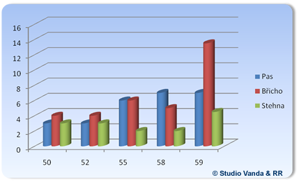 Ultrasound liposuction results - age group 50 - 59